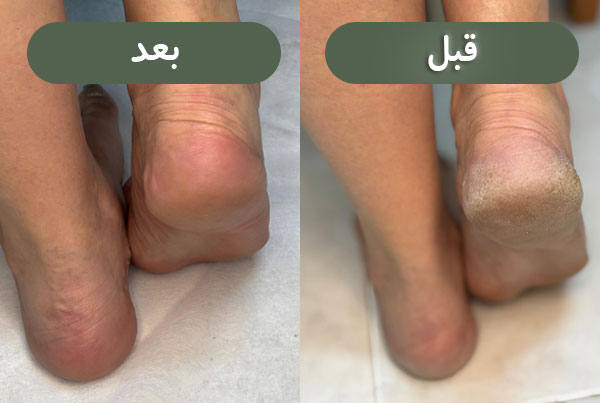 نمونه کار سالن زیبایی اتنا قشم