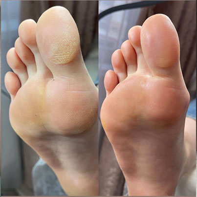 پدیکور در قشم